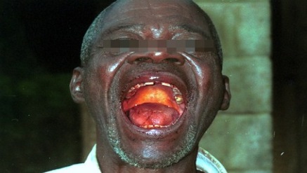Death of Accra Bound Passenger Sparks Ebola Panic at MMIA