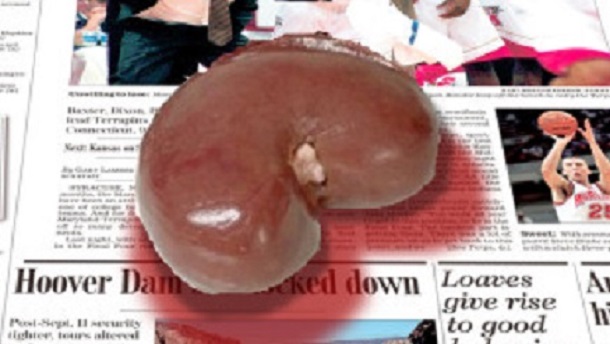 FG Warns of High Increase in Illegal Kidney Harvest
