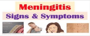 GPA Raises Alarm, Says Malaria Vaccine Can Cause Meningitis