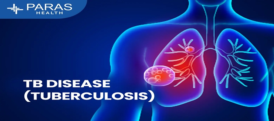 FG Deploys Technology, Approves $54m Drugs to Tackle Tuberculosis