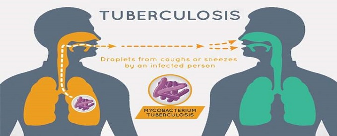 Nigeria Gets Tuberculosis Notification Mobile App – Nigerian ...